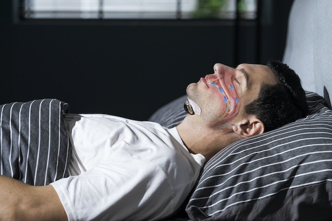 Schlafmi Z3 - Das intelligente Anti-Snoring-Gerät Medien 3