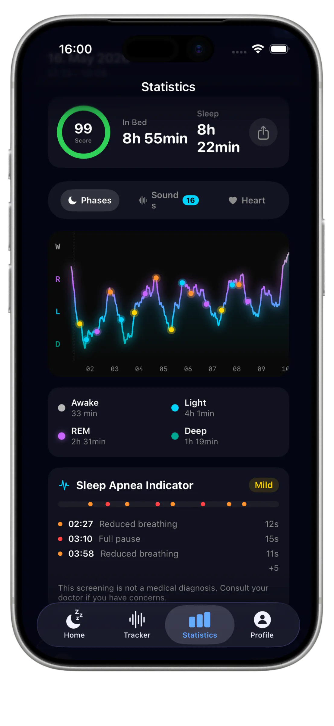 SleepTrace gallery image