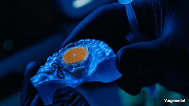 MouthPad^ gallery image