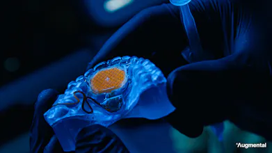 MouthPad^ gallery image