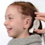 Microtia surgery in Delhi