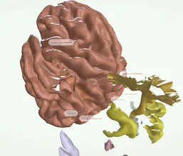 BrainLens gallery image