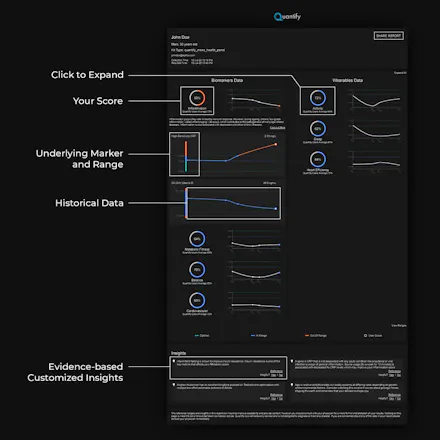 Quantify gallery image