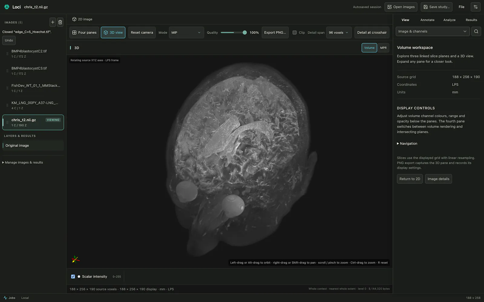 Loci screenshot 10