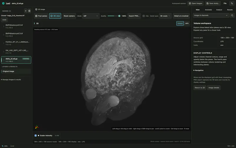 Loci screenshot 10