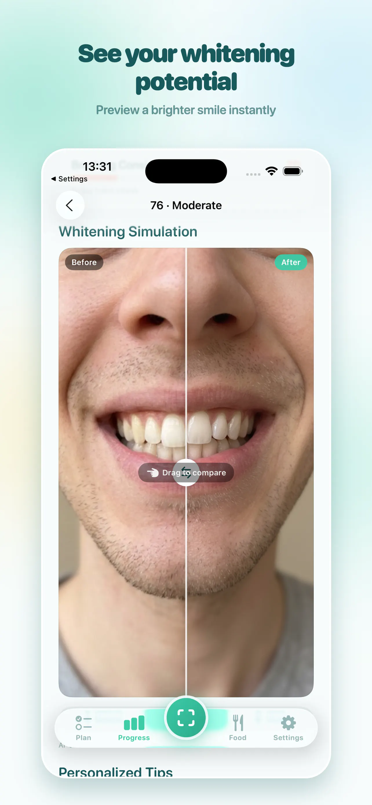 ScanDent: AI Dental Scanner gallery image