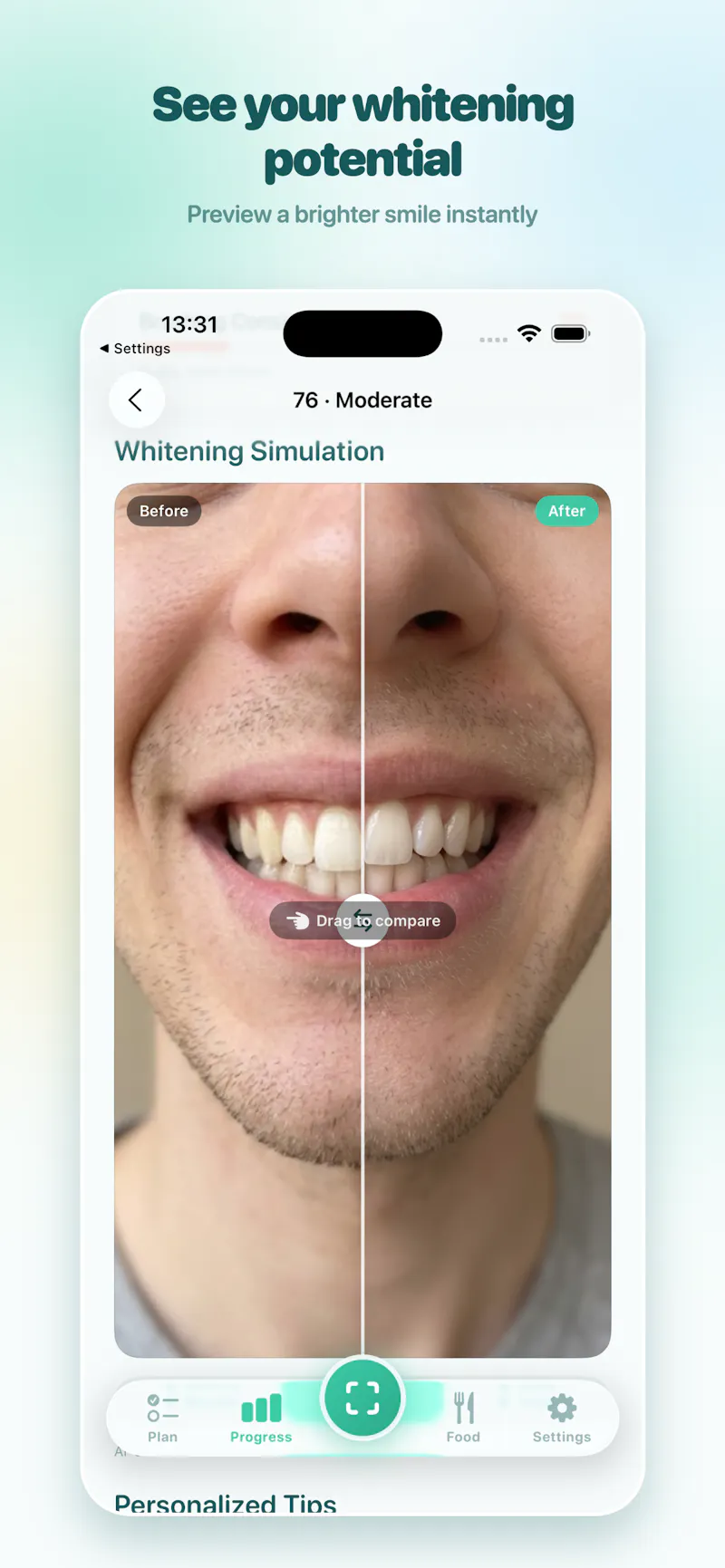 ScanDent: AI Dental Scanner screenshot 2