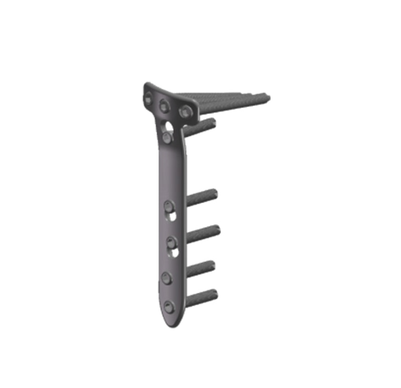 Periarticular Locking Plate System gallery image