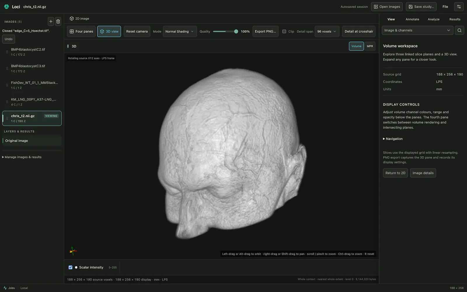 Loci screenshot 9