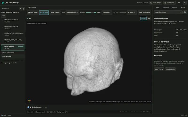 Loci screenshot 9