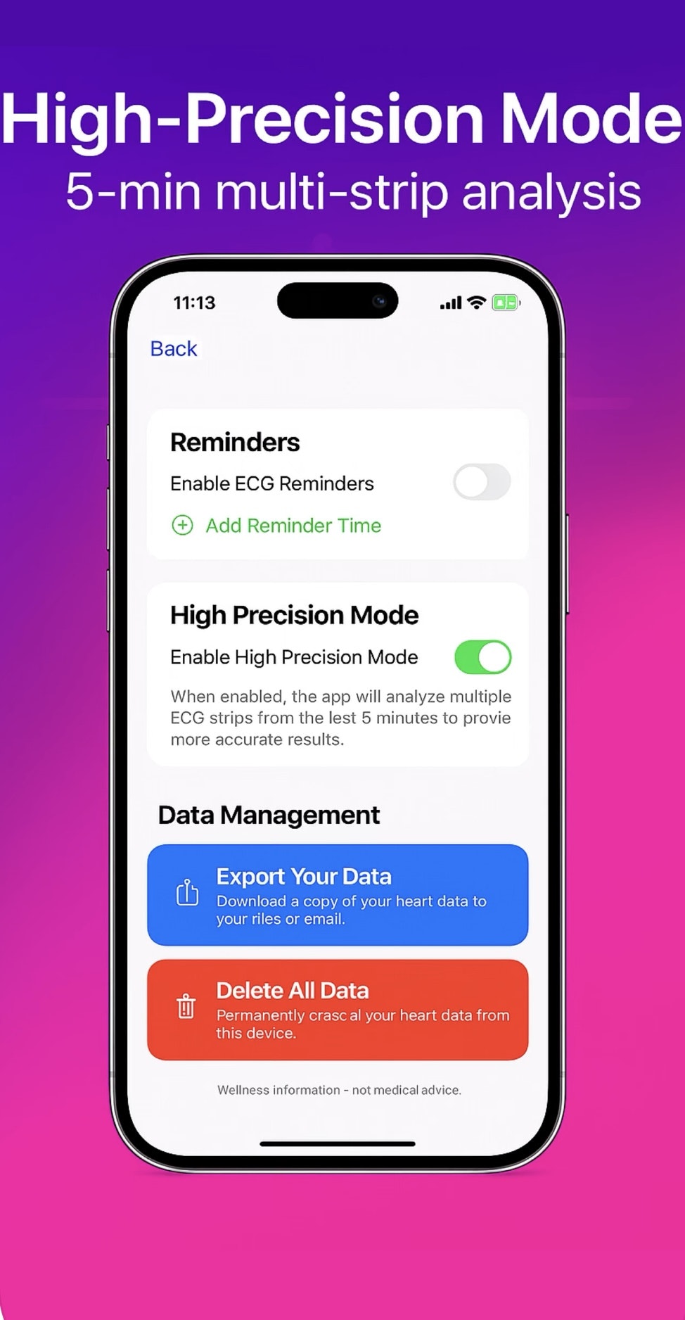心拍数の断片化 - Apple Watch ECGからストレスおよび回復スコアまでメディア3