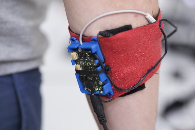 Open Bionics gallery image