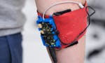 Open Bionics image