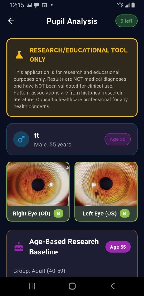 PupilMetrics Research Tool gallery image