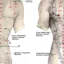 Acupuncture for Chronic Back Pain