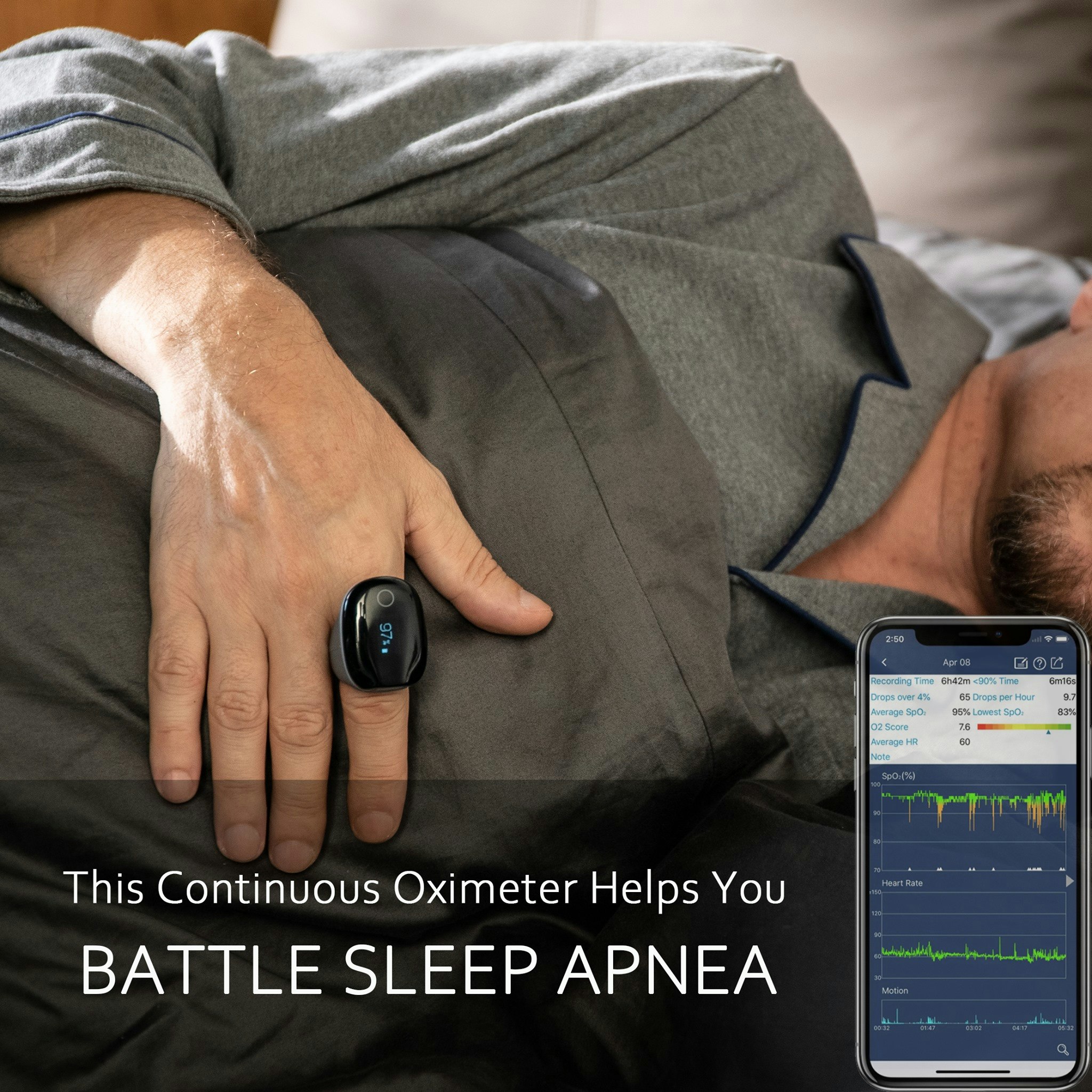 O2ring - Continuous Ring Oxygen Monitor gallery image