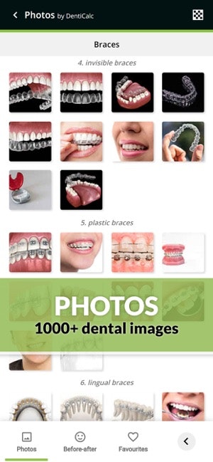 DentiCalc gallery image