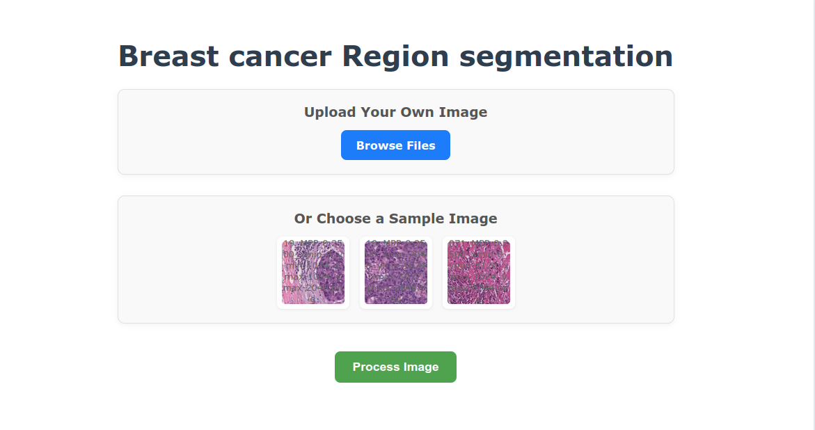 Mídia 1 de Software de imagem de tecido de câncer de mama - Deixe a IA ajudar a encontrar as várias regiões da imagem do tecido
