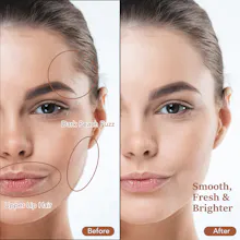 PELCAS Electric Dermaplaning Tool Kit gallery image