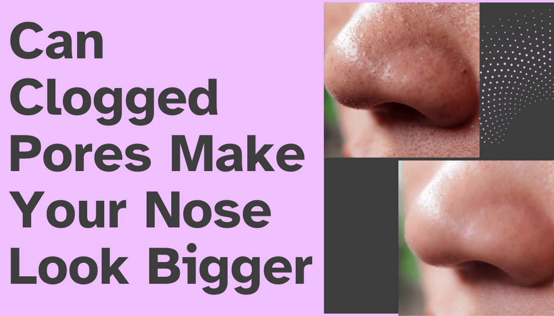 Pore Clogger Checker media 2