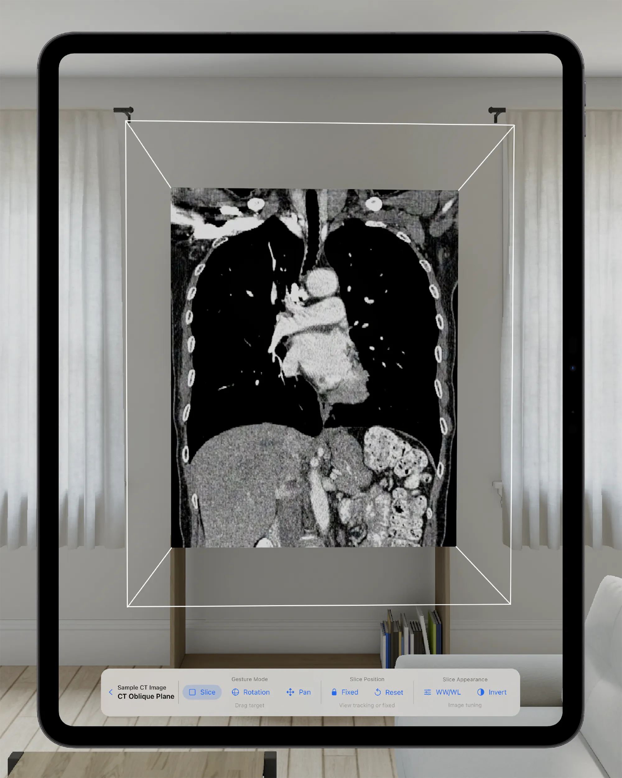 VoxelVision - DICOM Viewer gallery image