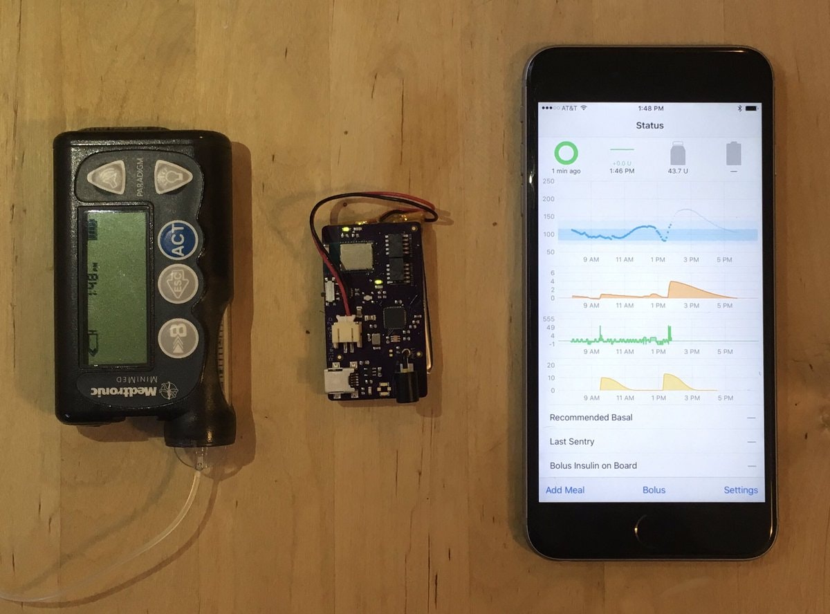 Loop for Type 1 Diabetes gallery image