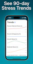Heart Rate Fragmentation gallery image