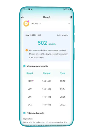 Accofrisk AI watch gallery image