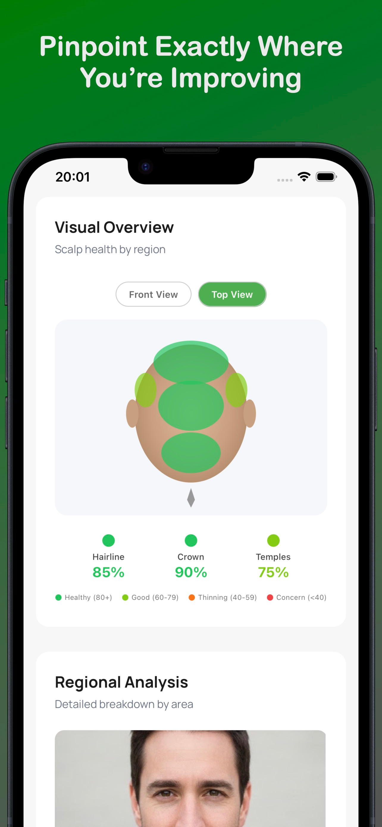 Trichometrics gallery image