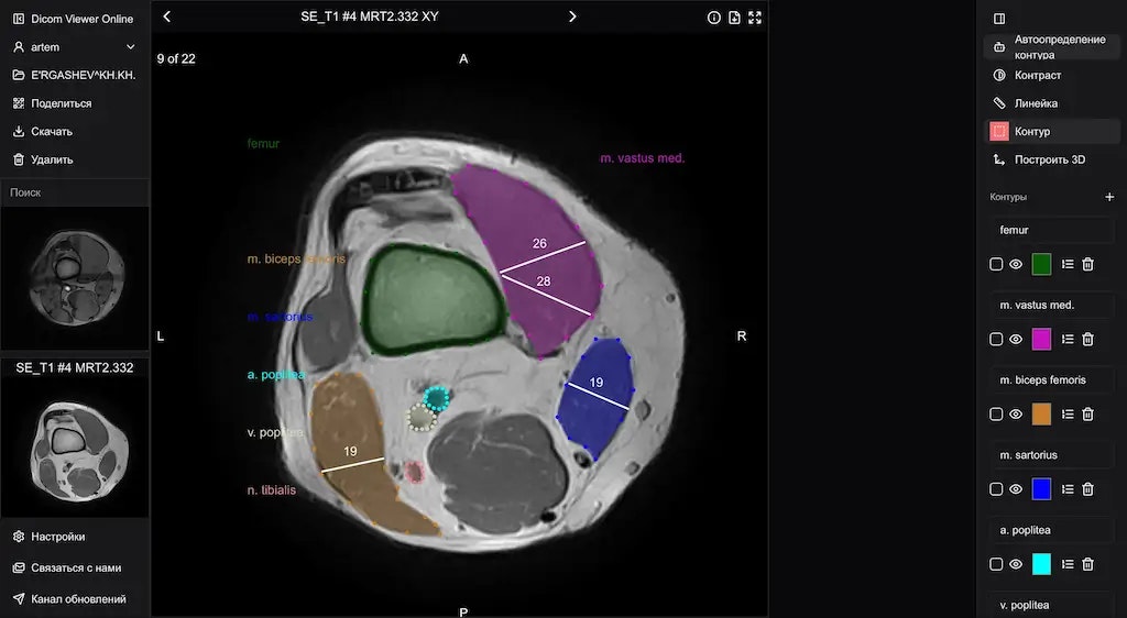 Dicom Viewer Online media 3