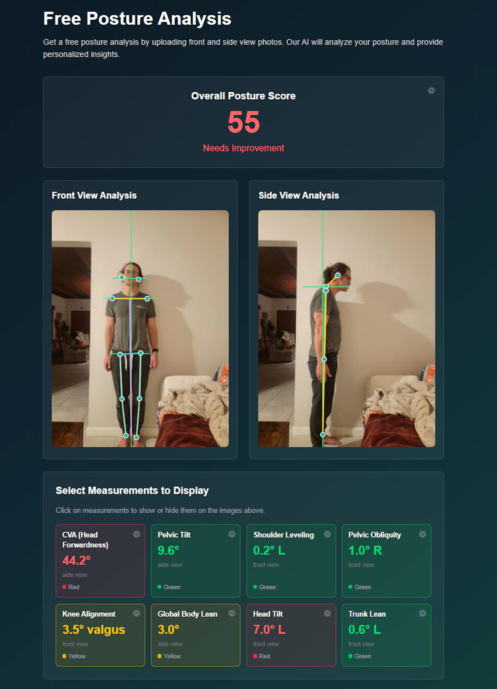 Free Posture Analysis screenshot 3