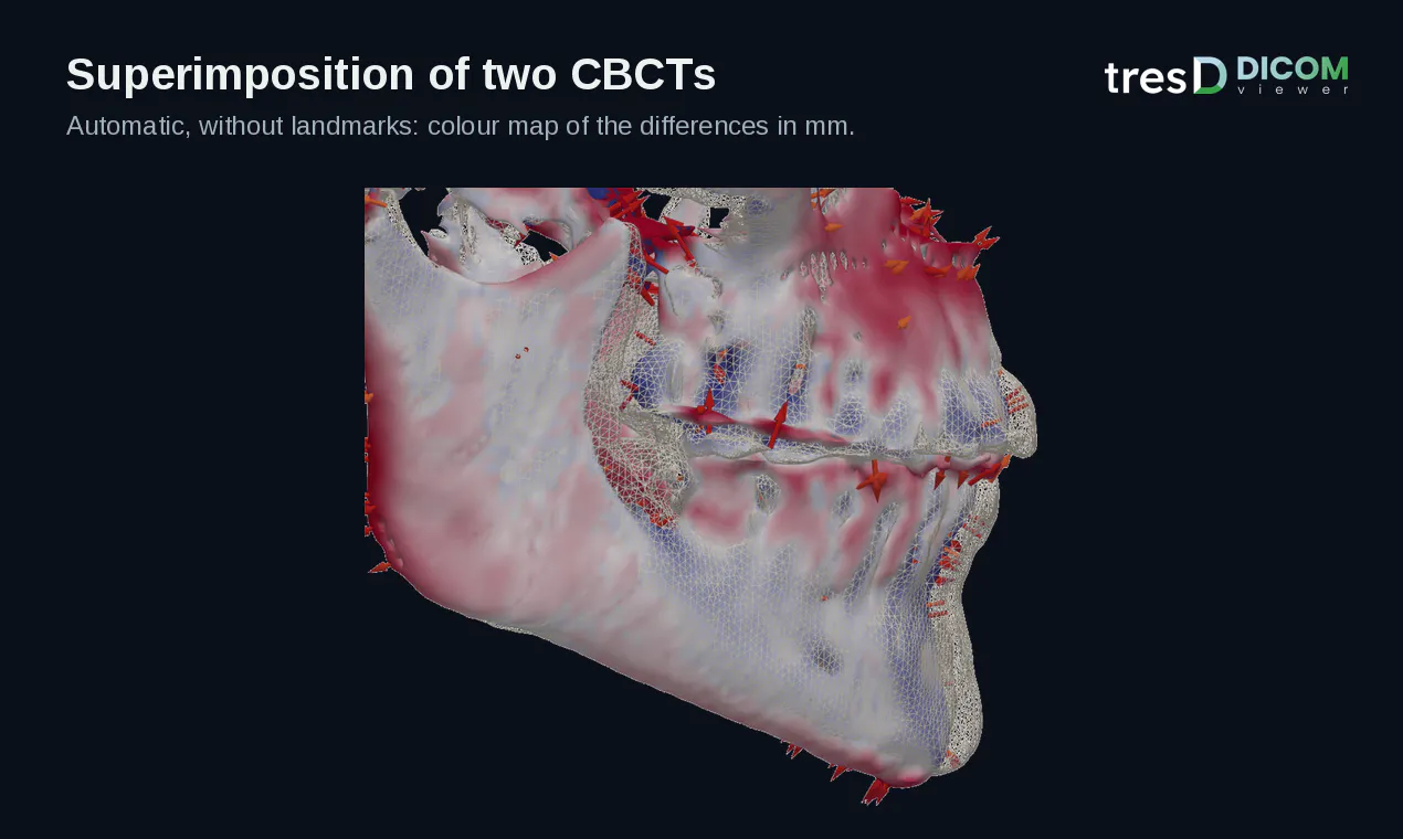 tresD DICOM gallery image