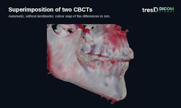 tresD DICOM gallery image