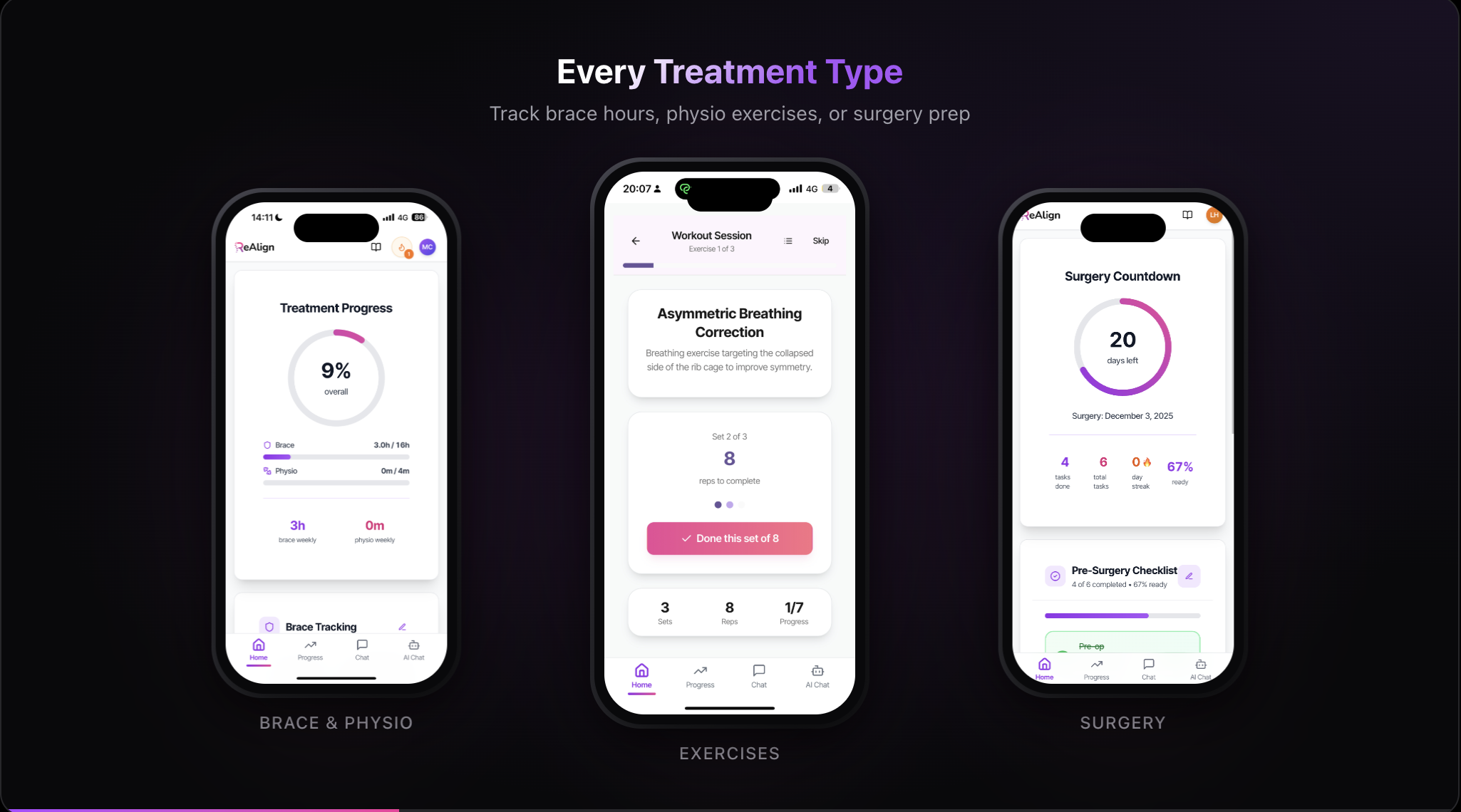 ReAlign gallery image