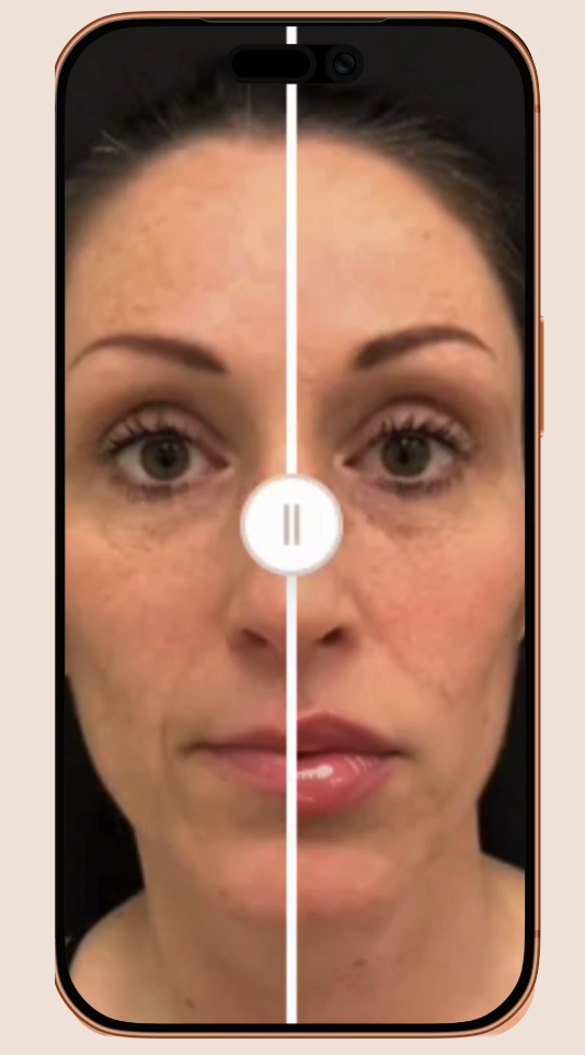 PREEVŪ Plastic™ - Main product screenshot demonstrating key features and user interface