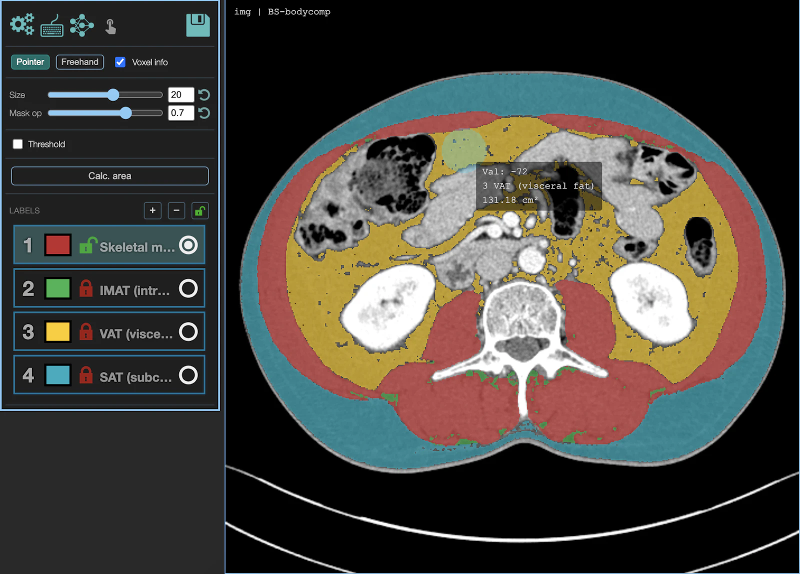 MedSeg screenshot 2