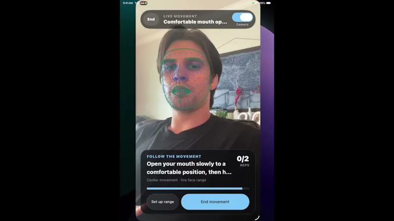 Remend screenshot 1 (video preview)