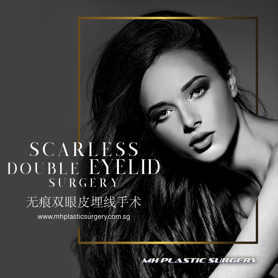 Eye Bag Removal | Thread lift gallery image
