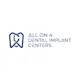 Dallas All On 4 Dental Implant Center