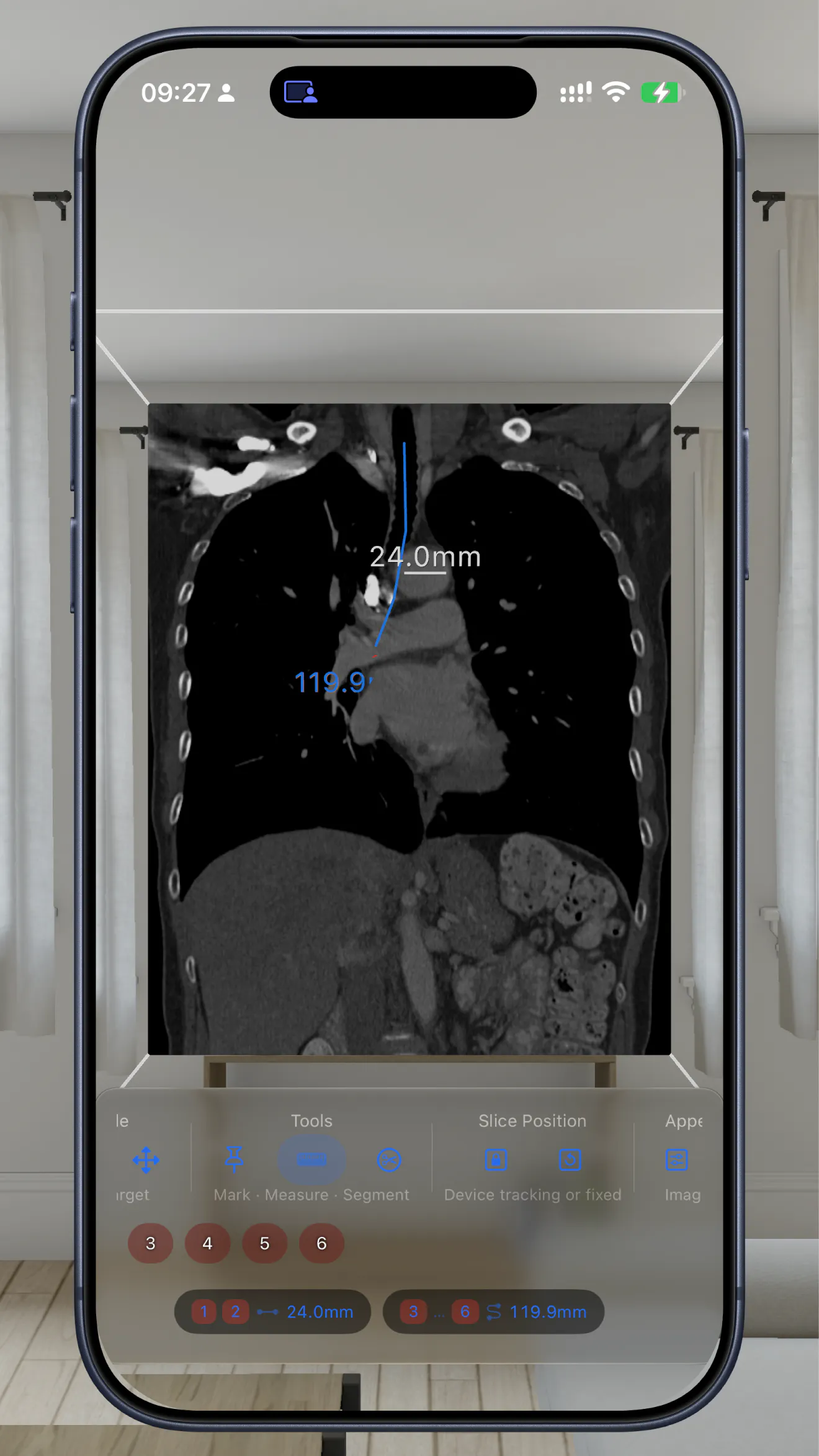 VoxelVision - DICOM Viewer gallery image
