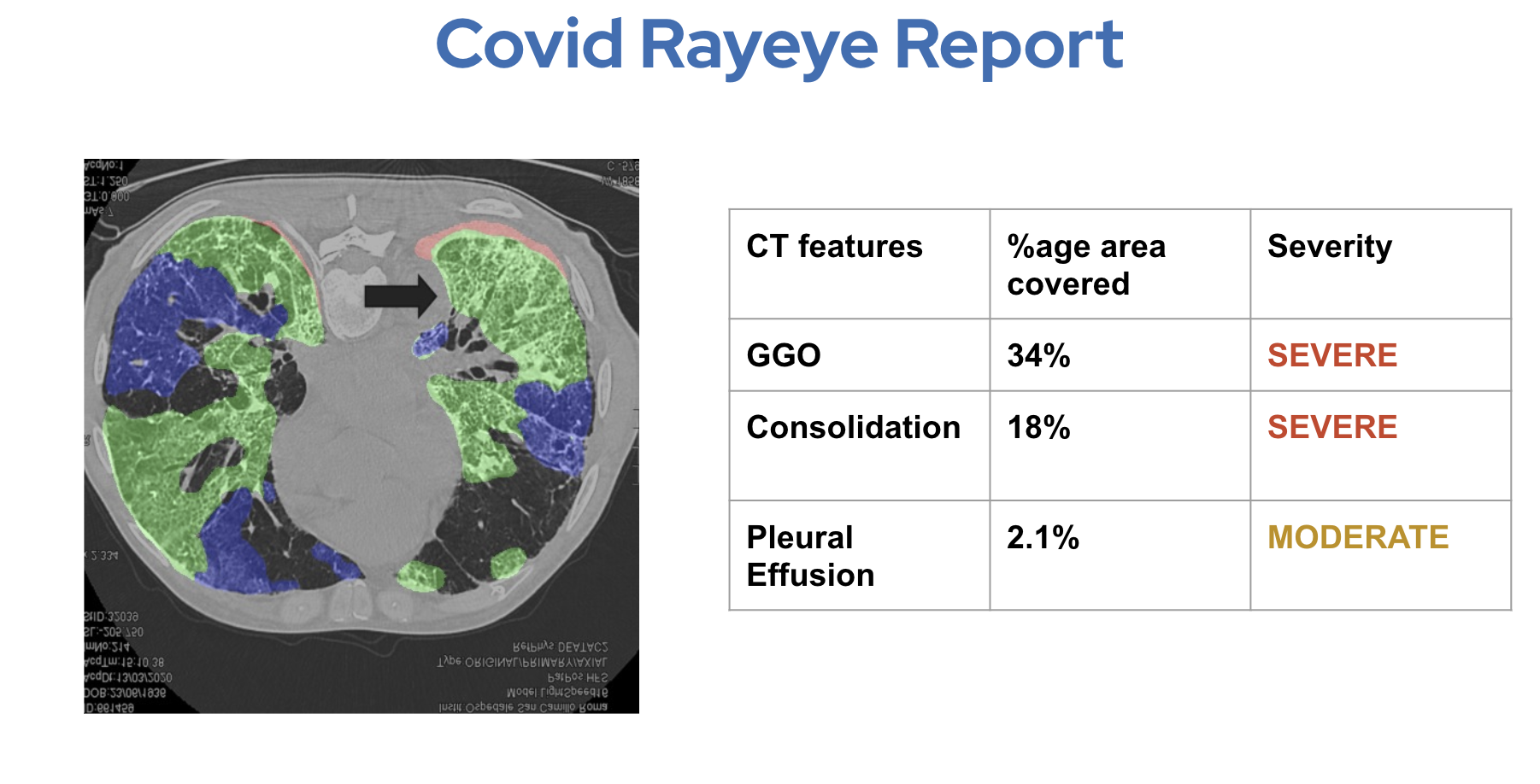 RayEye gallery image
