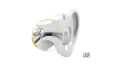 iAR. First 100% Invisible Hearing Aid gallery image