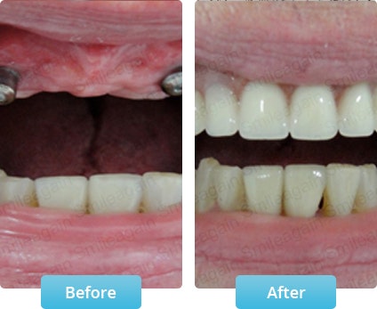 Dental Implant  - Main product screenshot demonstrating key features and user interface