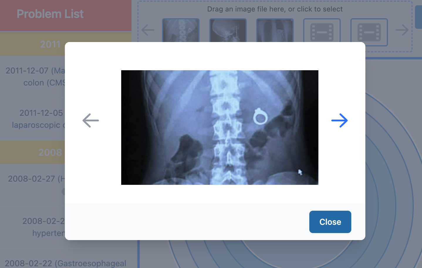 eSpiral - At-a-glance visualizations for clinicians media 2