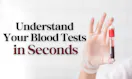 AI Blood Test Analysis