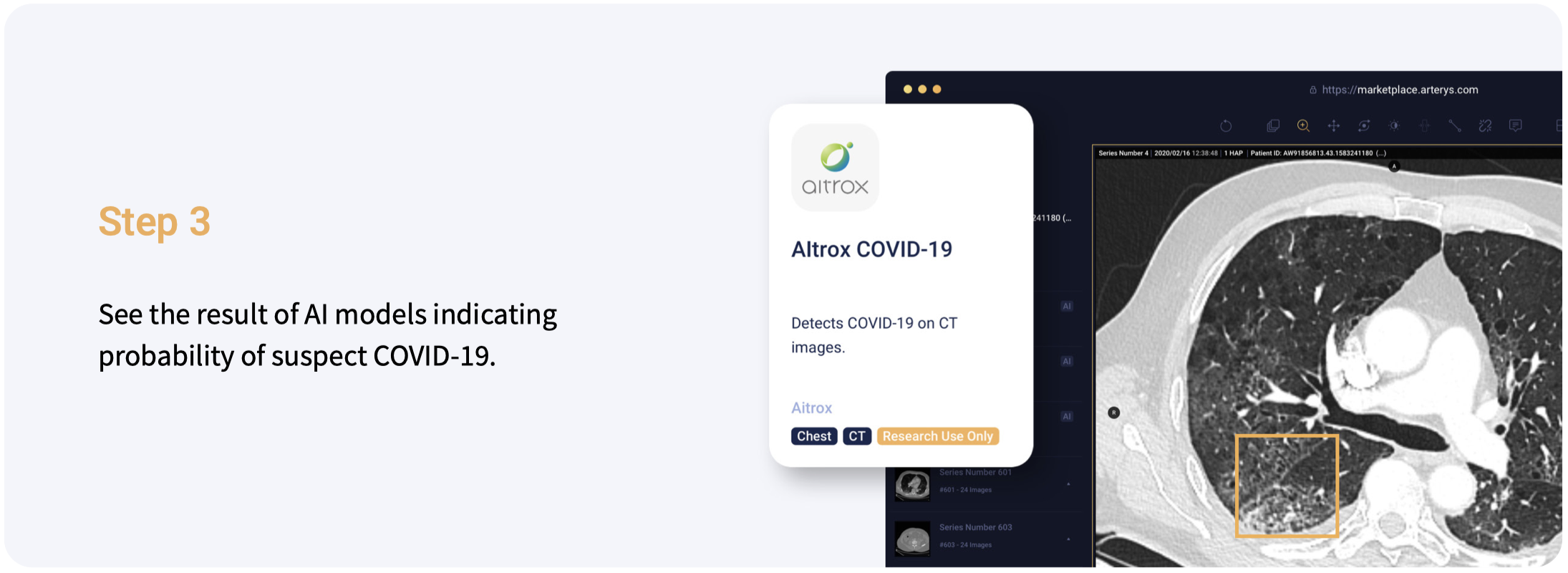 Arterys Marketplace gallery image