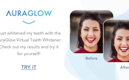 Virtual Teeth Whitening media 2