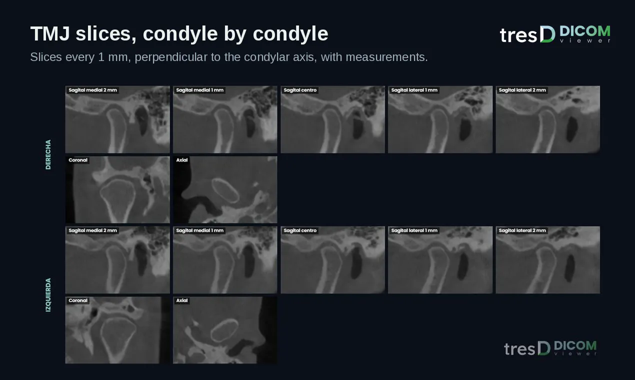 tresD DICOM gallery image