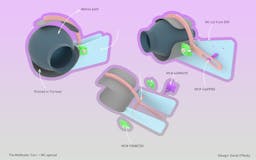 Open Lung - Open Source Ventilator media 2