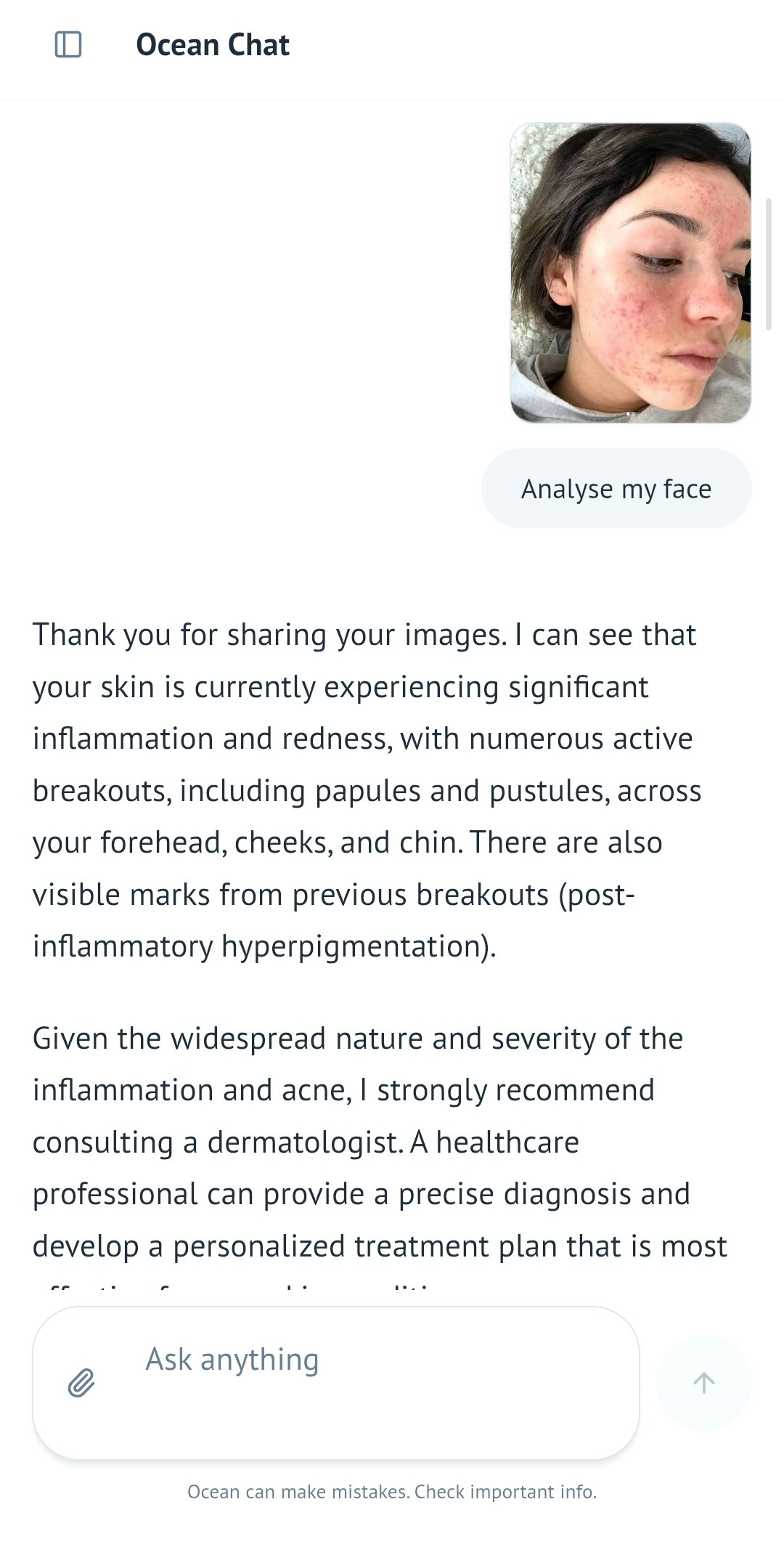Ocean Chat - Chatgpt for Health gallery image
